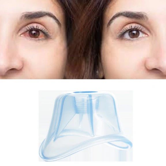 Augentropfen-Applikator | Ohne Blinzeln - Image 3